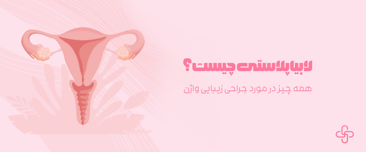 لابیاپلاستی