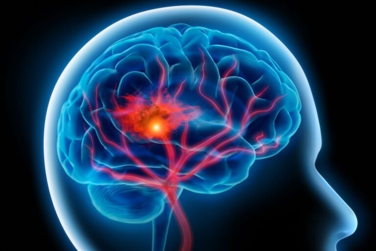 علائم سکته مغزی چیست؟ نشانه هایی که باید به آنها توجه کرد