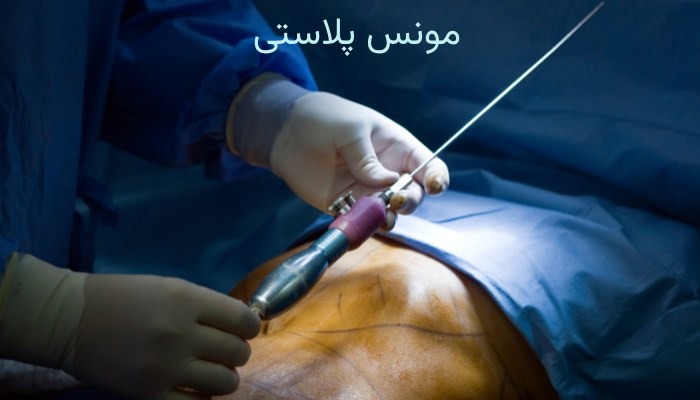 عمل‌ های زیبایی زنان قابل انجام در ایران